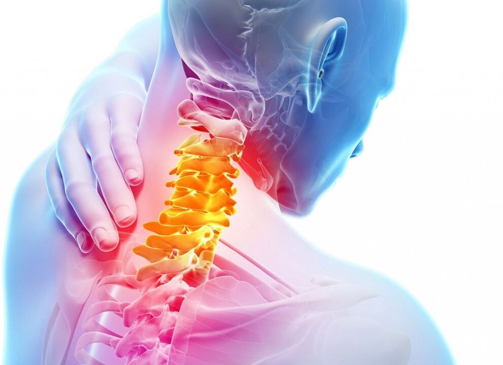 Was ist zervikale Osteochondrose