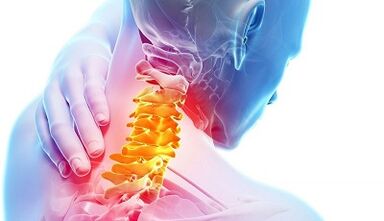 Ursachen für zervikale Osteochondrose